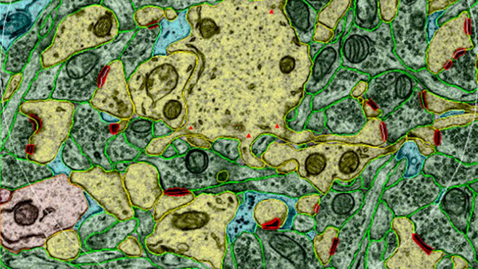 Image from an electron micrograph through a single section plane illustrating spiny dendrites, nonspiny dendrites, excitatory axons, excitatory synapses, astroglia, and microglia.